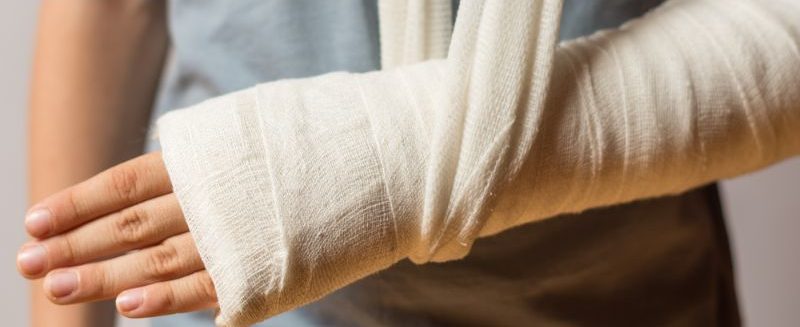 Mơ Bị Gãy Tay Điềm Báo Gì Và Những Con Số Liên Quan Mới Nhất 2025 7 Mộng bản thân té xe gãy tay đánh ngay 12 và 73